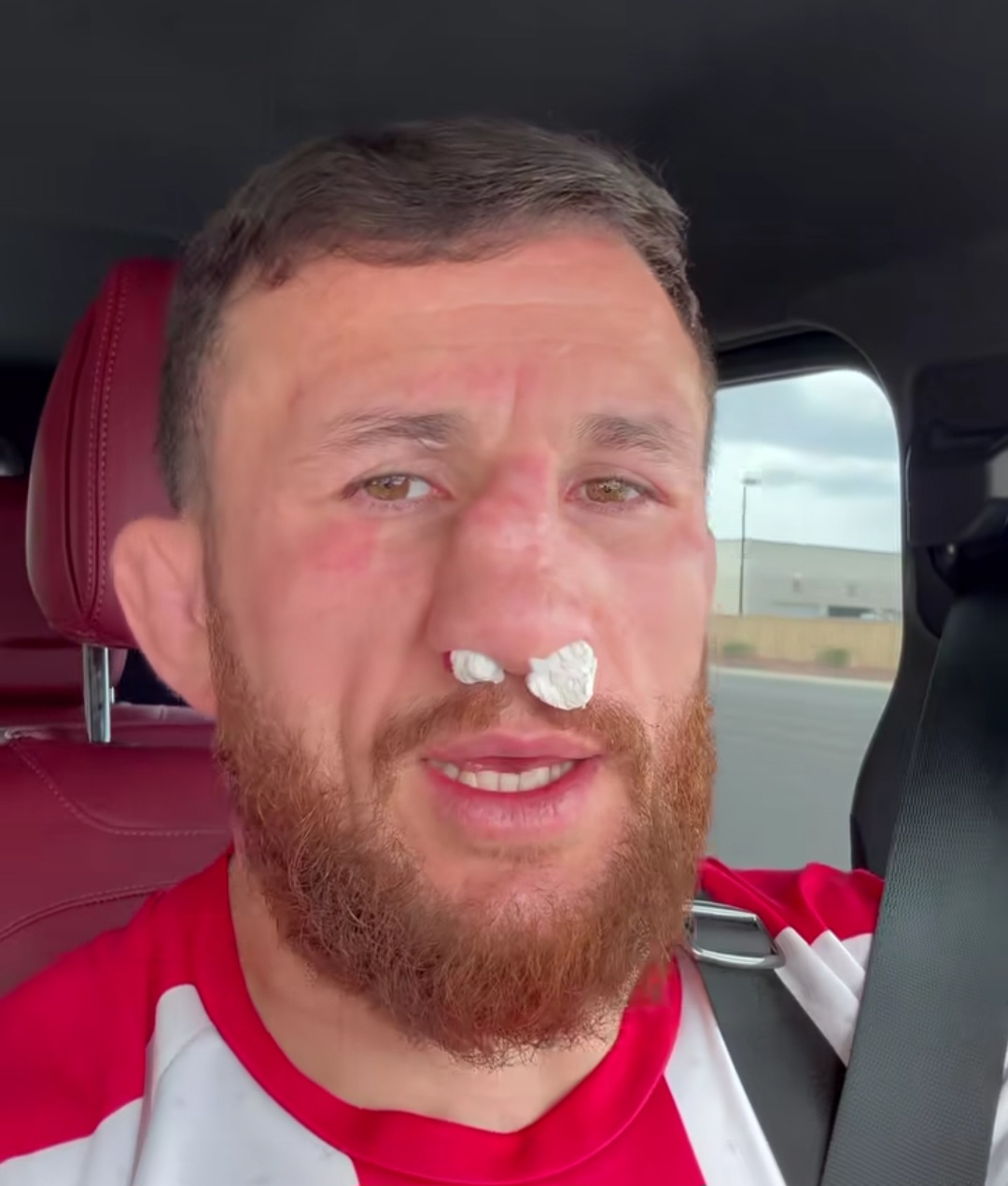 ميراب دفاليشفيلي يكشف عن كسر جديد في أنفه ويصر على عدم الخضوع للجراحة